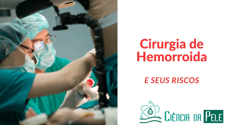 Cirurgia de Hemorroida: Entenda o Procedimento e Seus Benefícios