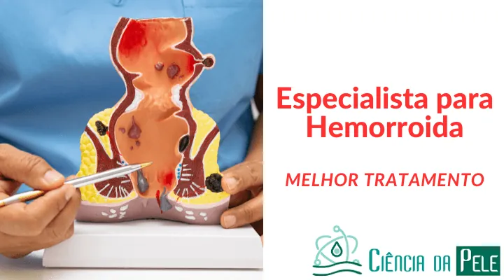 Especialista para hemorroida: Como Identificar e Tratar