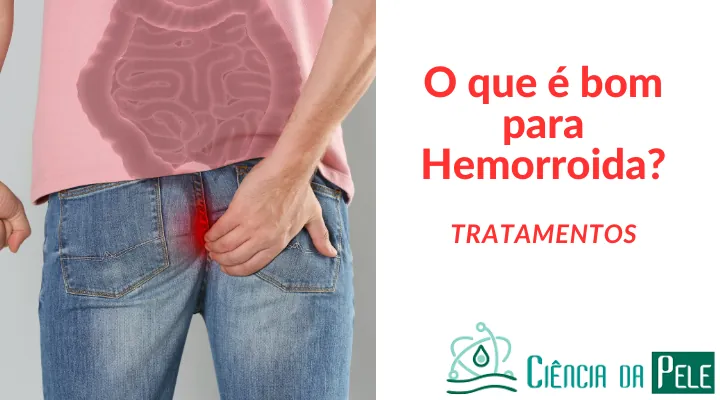 O que é bom para hemorroida: Tratamentos Eficazes