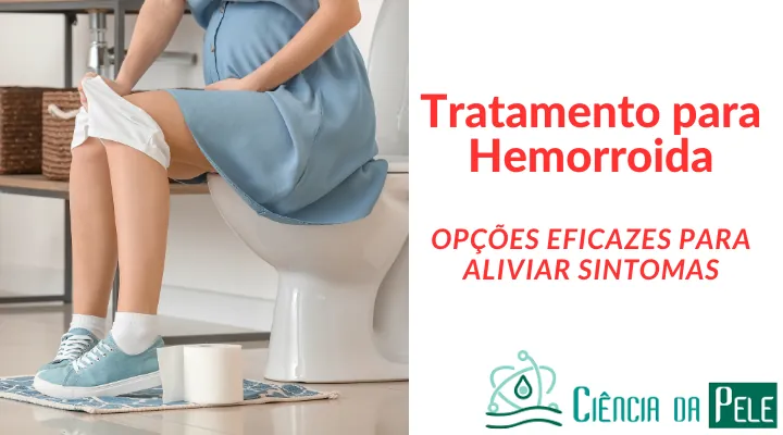 Tratamento para Hemorroida: Opções Eficazes para Aliviar Sintomas