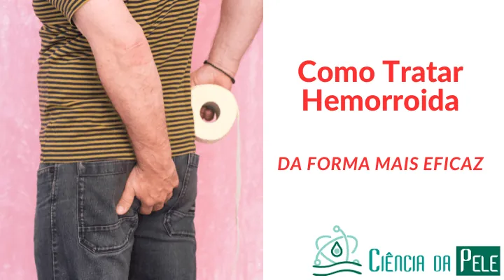 Como Tratar Hemorroida: Dicas para Combater Sintomas