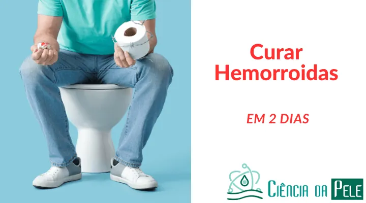 Curar hemorroidas em 2 dias: Opções de tratamento