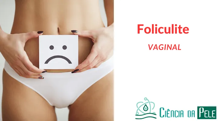 Foliculite Vaginal: Causas, Sintomas e Tratamentos