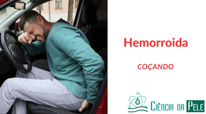 Hemorroida Coçando: Causas, Sintomas e Tratamentos Eficazes