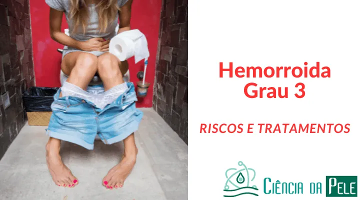 Hemorroida Grau 3: Sintomas, Tratamentos e Cuidados Essenciais