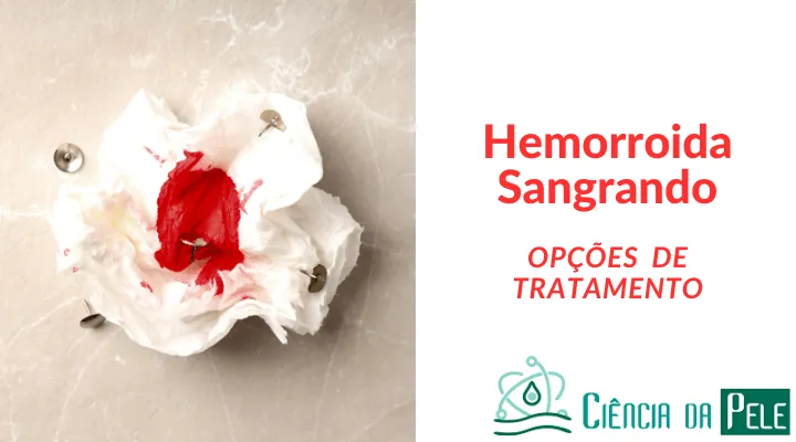 Hemorróida Sangrando: Causas, Sintomas e Tratamentos Eficazes