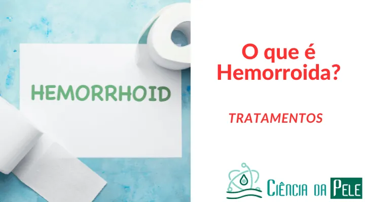 O que é hemorroida: causas e prevenções