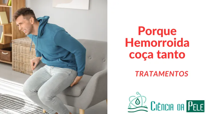 Porque hemorroida coça tanto: Causas e Soluções Eficazes