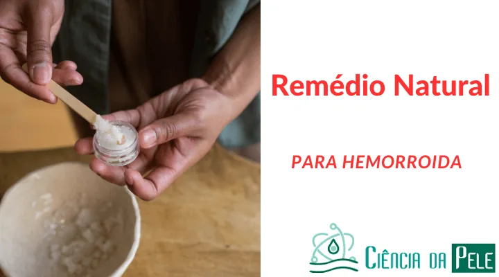 Remédio Natural para Hemorroida: Soluções Simples e Seguras