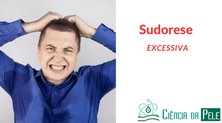 Sudorese Excessiva: Tratamentos disponíveis