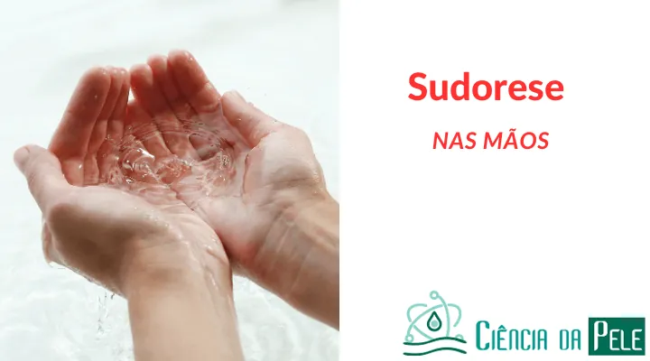 Sudorese nas mãos: Tratamentos não Cirúrgicos