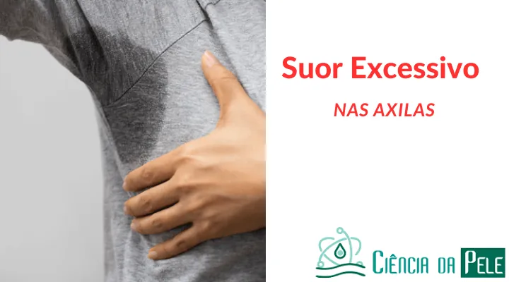 Suor excessivo nas axilas: 4 Opções de tratamentos