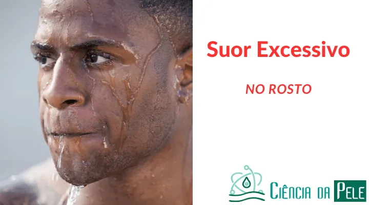 Suor Excessivo no Rosto: Causas, Sintomas e Tratamentos